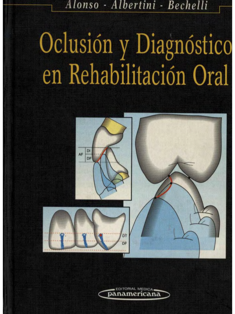 Oclusión y Diagnóstico en Rehabilitación Oral - Alonso, Albertini, Bechelli
