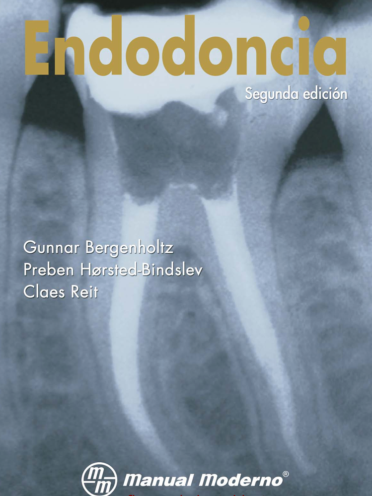 Endodoncia - G. Bergenholtz, P. Hørsted-Bindslev, C. Reit
